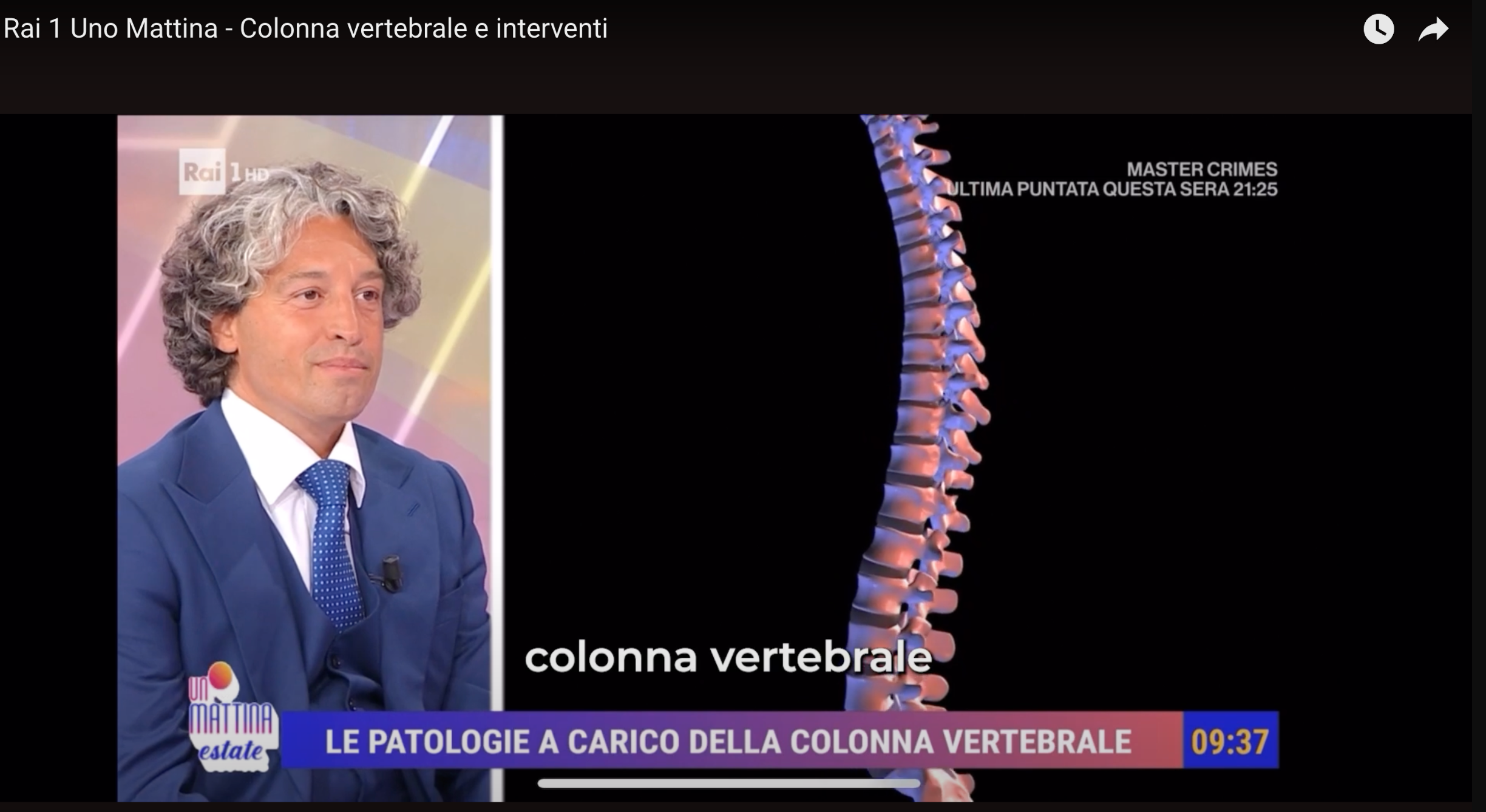 colonna vertebrale unomattina